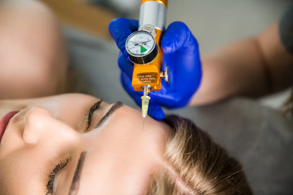 Karboksyterapia — terapia CO2 na cellulit, podkrążone oczy, blizny